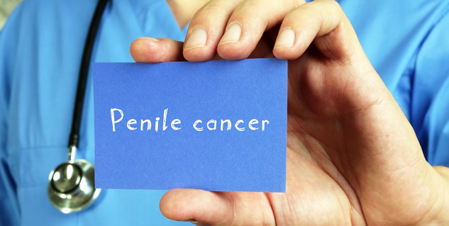 Penile Cancer Symptoms Risk Factors Treatment Onlymyhealth